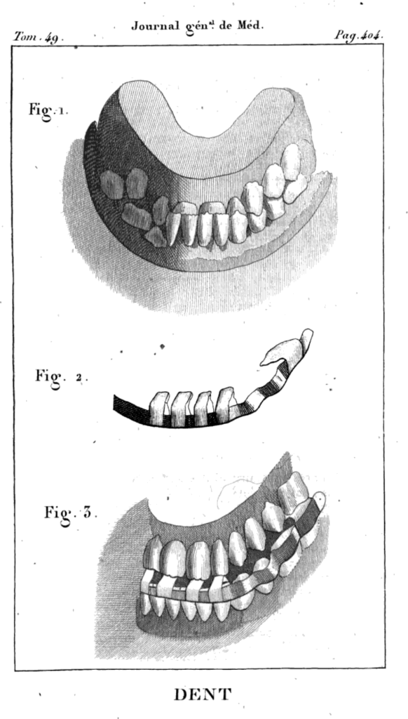 History of Orthodontics - History of Dentistry And Medicine | The ...
